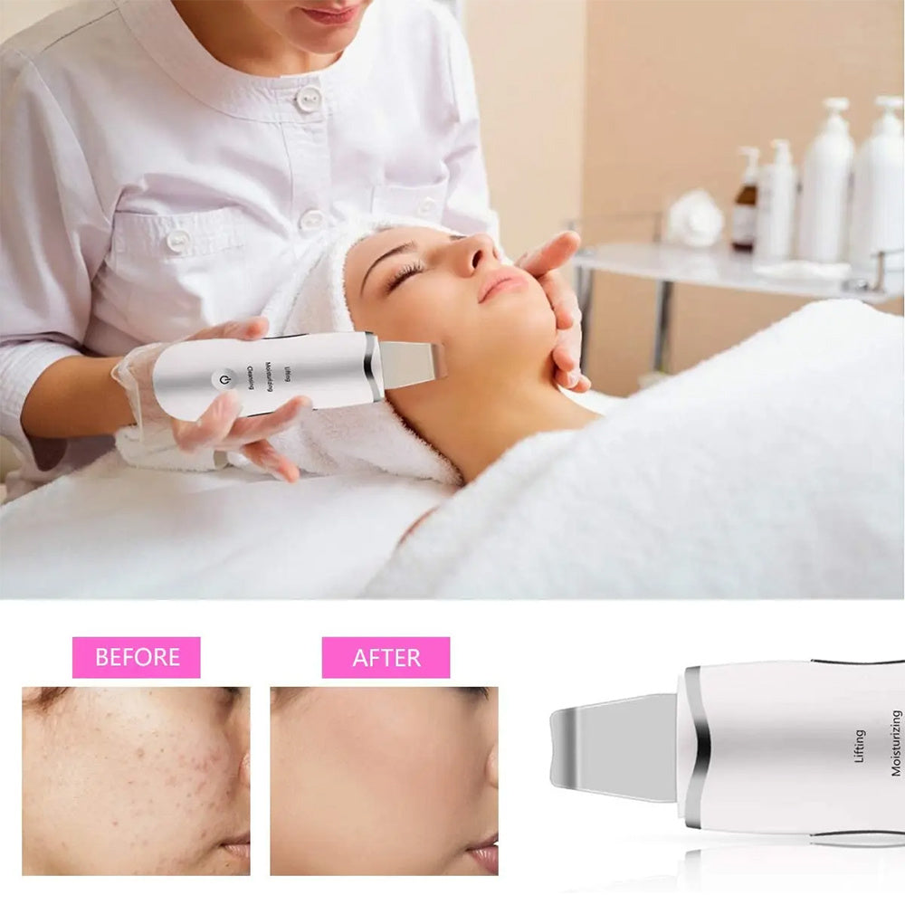 US Local 3-in-1 Ultrasonic Facial Spatula For Deep Cleansing, Electric Ultrasonic Skin Scrubber
