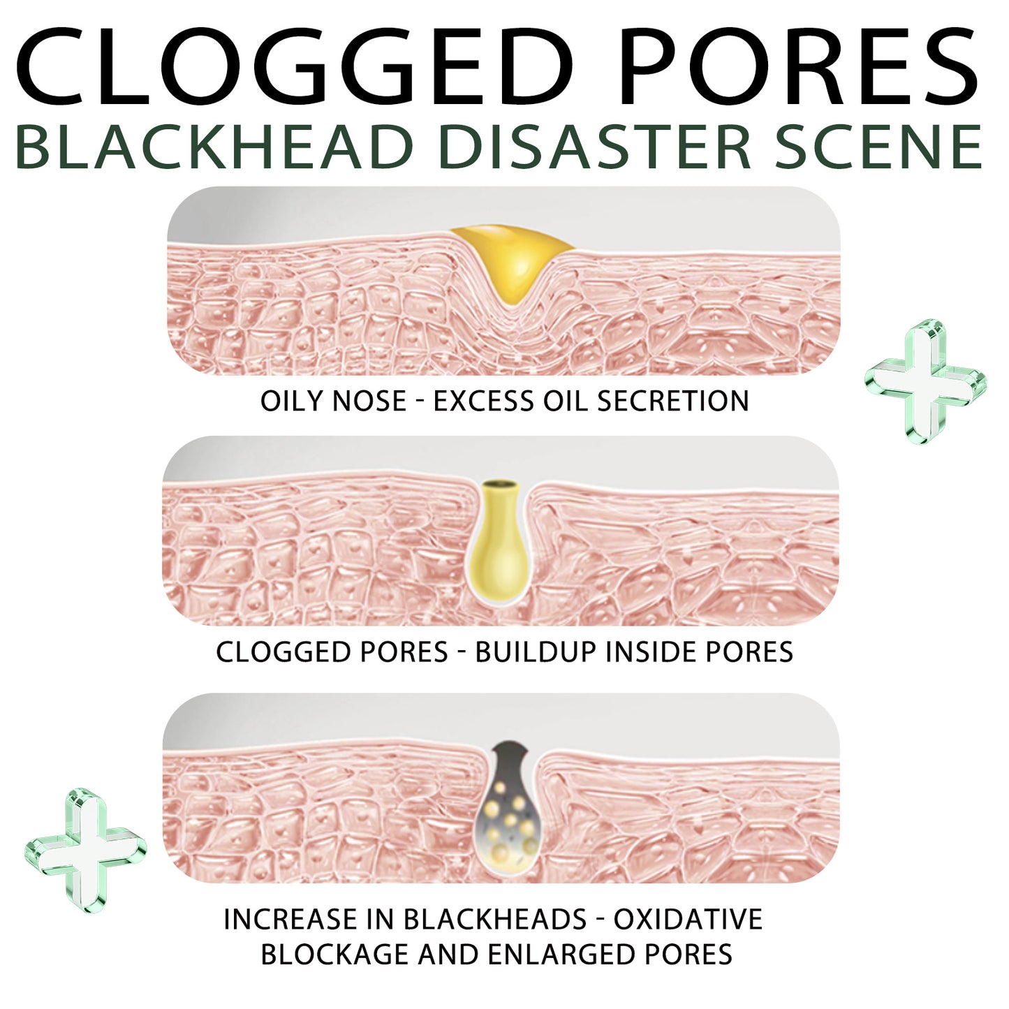 US Local Blackhead Remover Tools -15g Blackhead Creamwith 40Pcs Blackhead Pore Strips