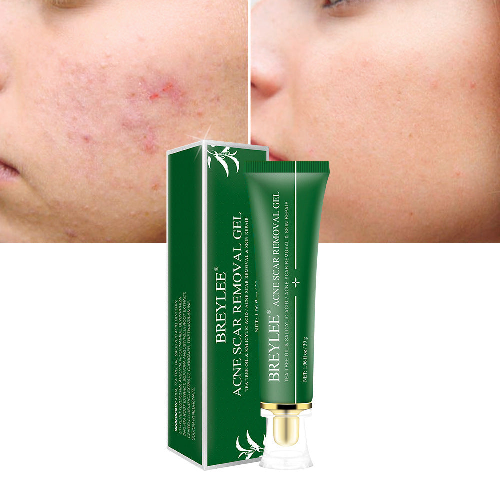 US Local Acne Scar Removal Gel Tea Tree Qu Dou Printing