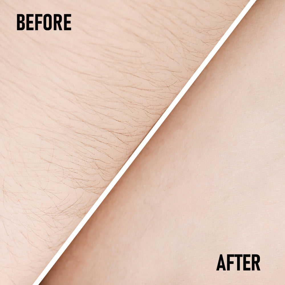 US Local PHOFAY PAIN FREE HAIRS REMOVAL CREAM