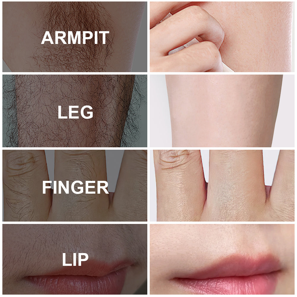 US Local PHOFAY PAIN FREE HAIRS REMOVAL CREAM