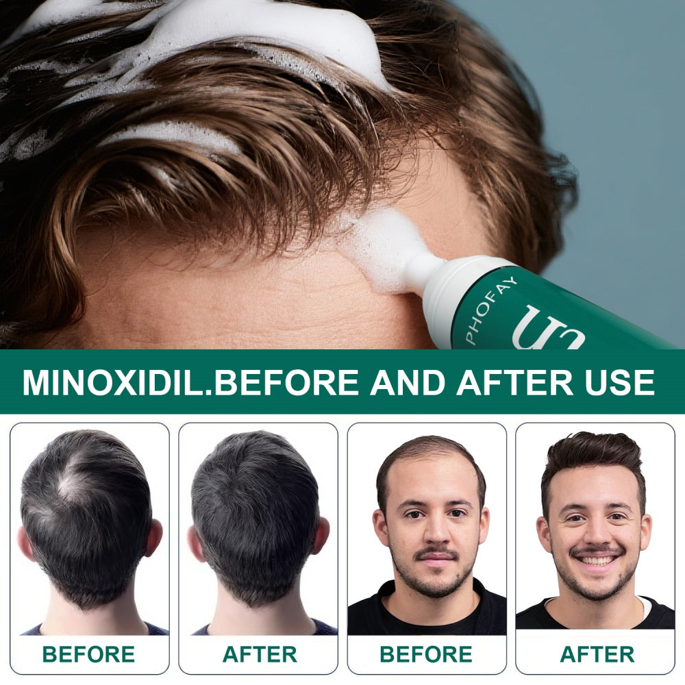 US Local CH004 Minoxidil Anti-Hair Loss Mousse