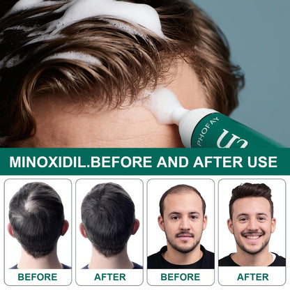 US Local CH004 Minoxidil Anti-Hair Loss Mousse