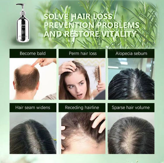 US Local Sysni Organic Rosemary Shampoo And Tea Tree Special Shampoo, Keratin NourIshing Shampoo ,Promote Hair Growth, Strengthening Shampoo, Prevent Hair Loss Cleansing Shampoo,Deep Cleans, Refreshes Scalp, F