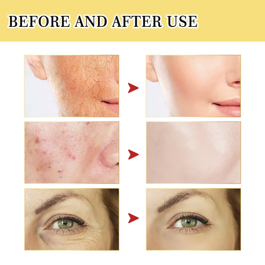 USA Local Snail Serum Collagen Facial Serum Original