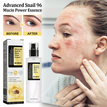 US Local Snail Serum Collagen Facial Serum Original