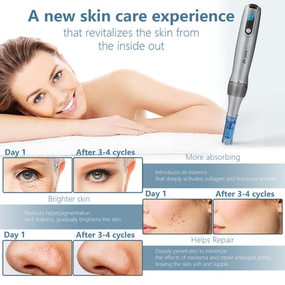 US Local Electric Microneedle Derma Roller Pen With 15pcs Replacement Kit - Microneeding 0.25 Mm Derma Roller Beauty Pen For Women Men Tools