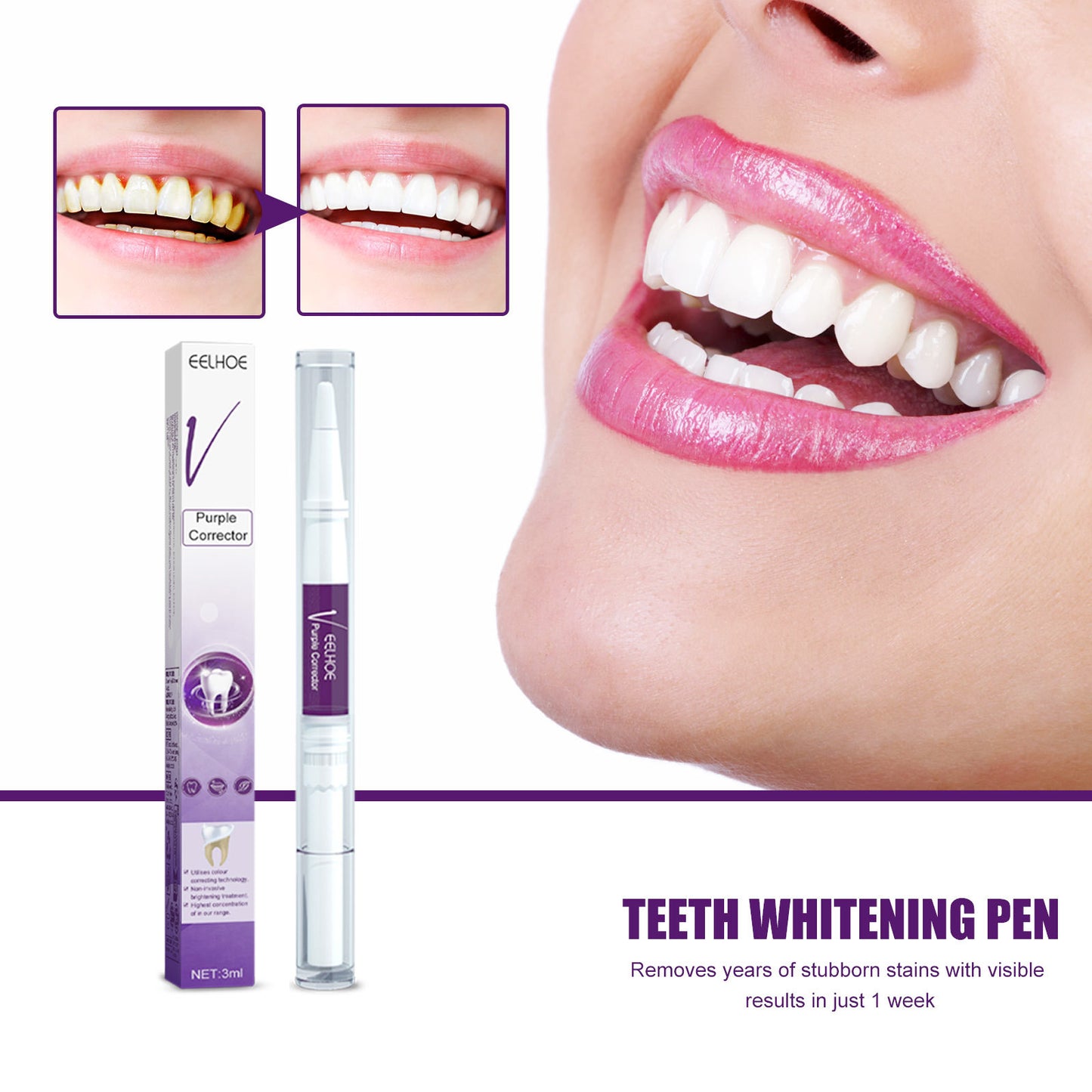 US Local EELHOE V34 Purple Toothbrush Oral Cleaning Tooth Cleaner, Stain Removal, Radiant Teeth, Oral Care Tooth Pen