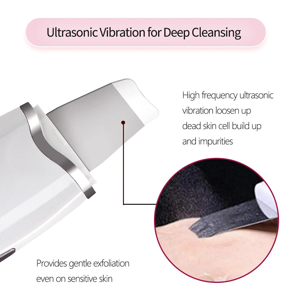 US Local 3-in-1 Ultrasonic Facial Spatula For Deep Cleansing, Electric Ultrasonic Skin Scrubber