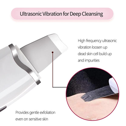 US Local 3-in-1 Ultrasonic Facial Spatula For Deep Cleansing, Electric Ultrasonic Skin Scrubber