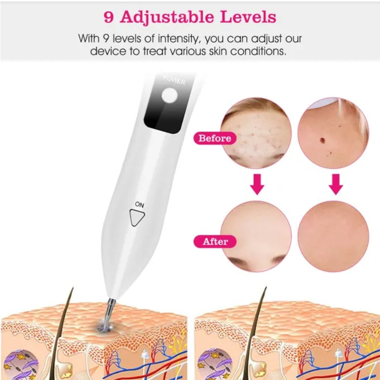 US Local Skin Tag Repair Kit Portable Beauty Equipment Multi-Level With Home Usage USB Charging LCD Level Adjustable 6 Replaceable Needles