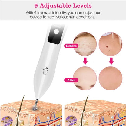 US Local Skin Tag Repair Kit Portable Beauty Equipment Multi-Level With Home Usage USB Charging LCD Level Adjustable 6 Replaceable Needles