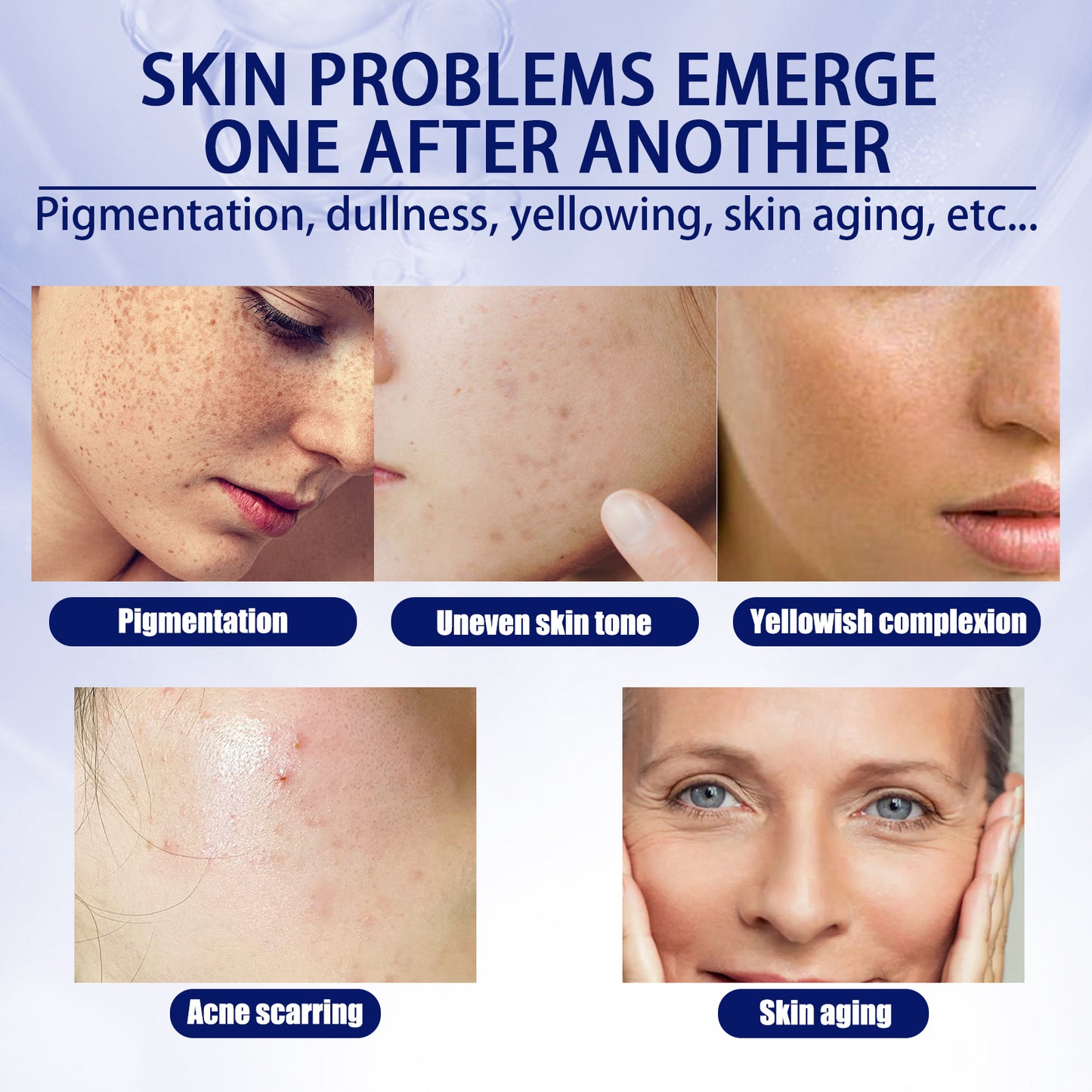 US Local EELHOE Anti-aging Vitamin C Facial Essence, Reduces Spots Acne Fine Lines, Moisturizes Facial Essence