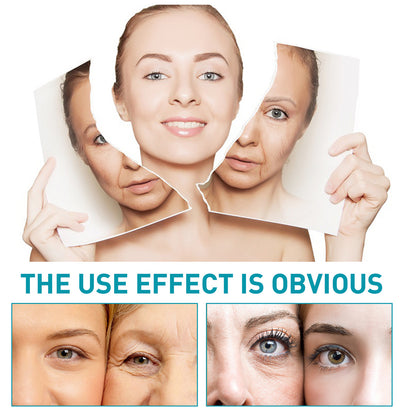 US Local EELHOE Hydroconus Peptide Anti-Wrinkle Serum, Skin Repair Crow's Feet Law Firming Wrinkles And Beautifying Skin