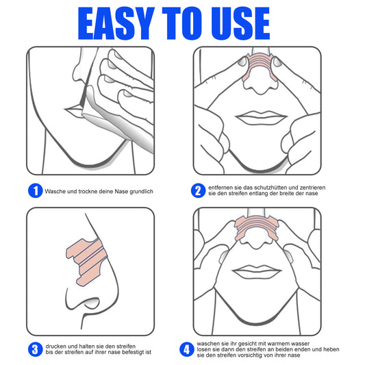 US Local South Moon Relieves Nasal Obstruction Nasal Dilation Discomfort Relieves Sleep Disorders Snoring Nose Ventilation Patch