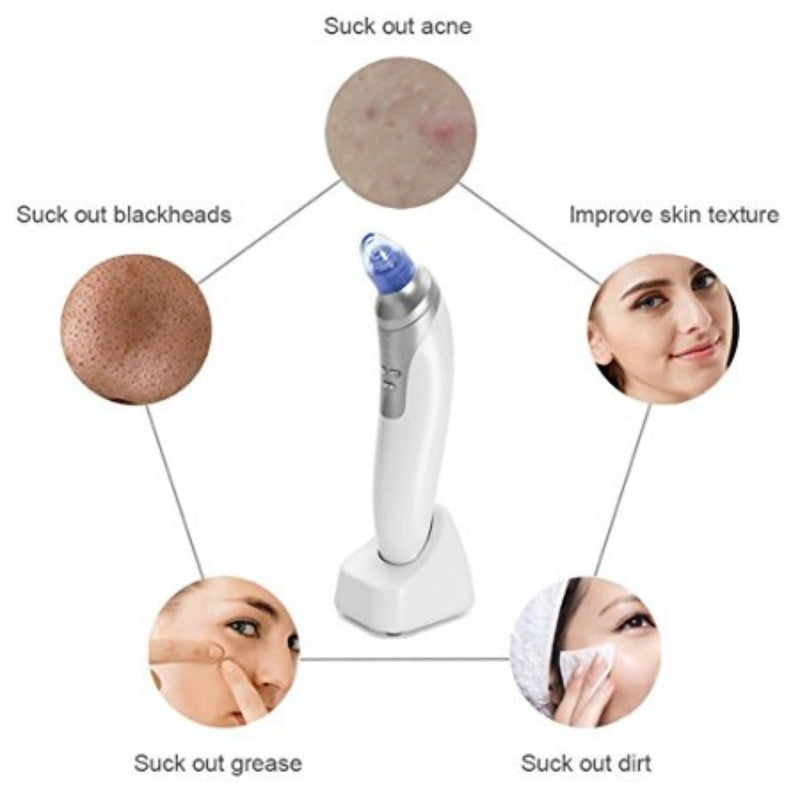 US Local Blackhead Remover
