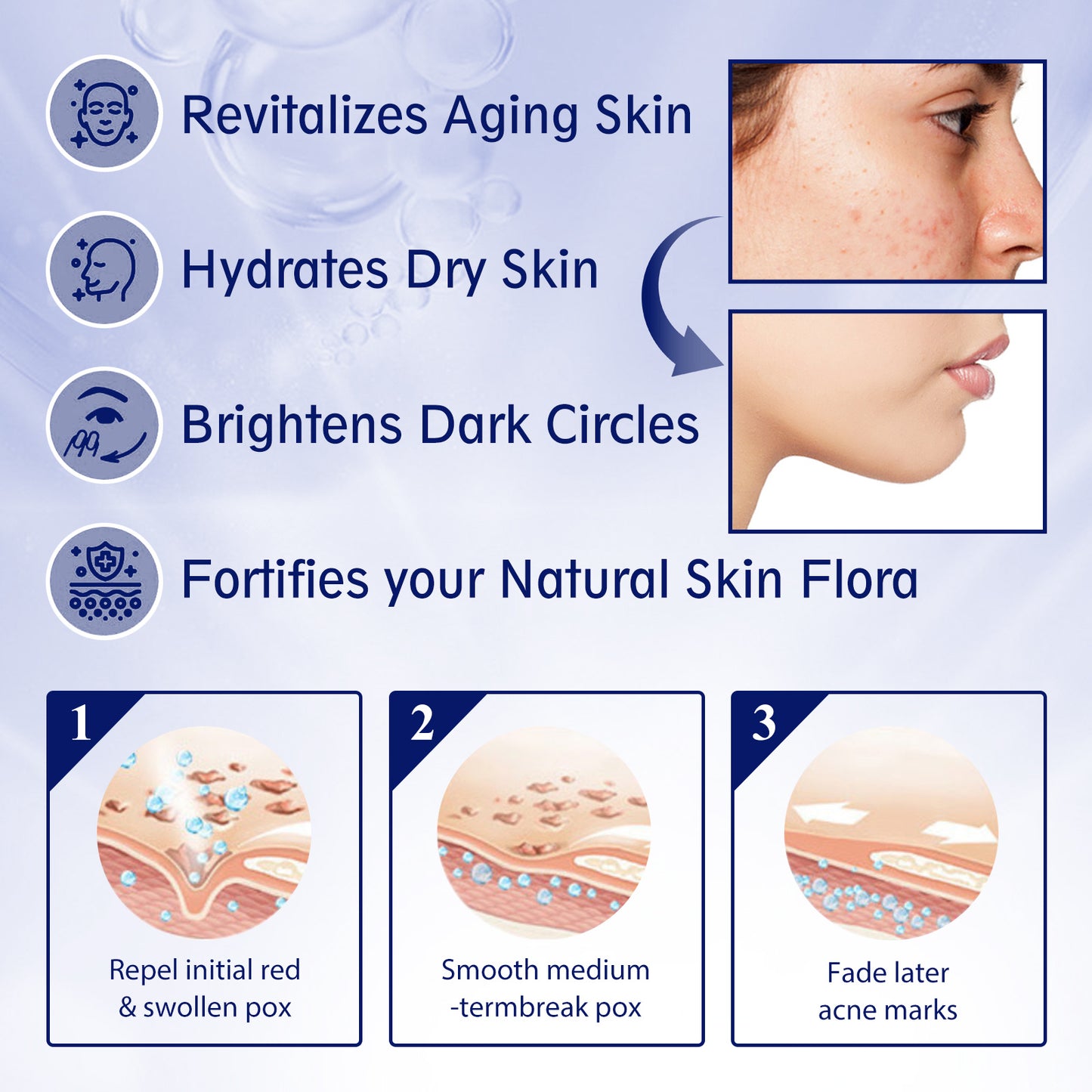 US Local EELHOE Anti-aging Vitamin C Facial Essence, Reduces Spots Acne Fine Lines, Moisturizes Facial Essence