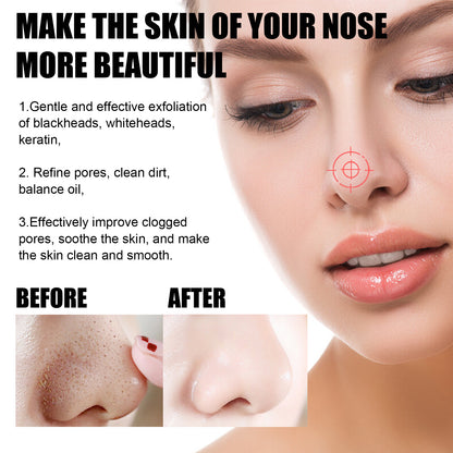 US Local Blackhead Remover Tools -15g Blackhead Creamwith 40Pcs Blackhead Pore Strips